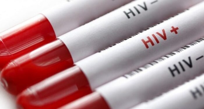 Səhiyyə Nazirliyi: ART sayəsində İİV artıq idarəolunan xəstəlikdir